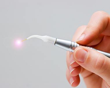 Hand holding a laser dentistry tool