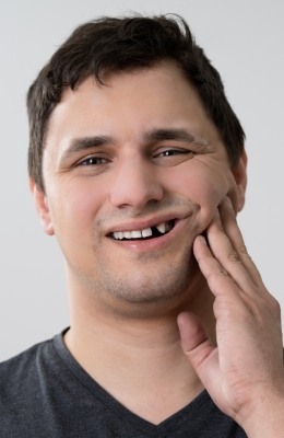 Man with missing tooth holding cheek in pain