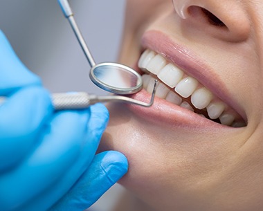 Closeup of smile during gum recontouring treatment