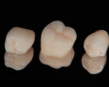 Three ceramic crowns on reflective, dark surface  