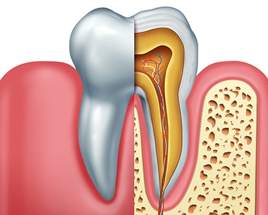 Animated healthy tooth after laser assisted root canal therapy
