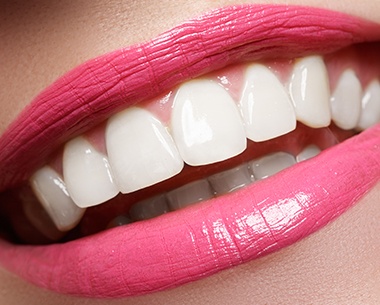 Closeup of smile after cosmetic dentistry