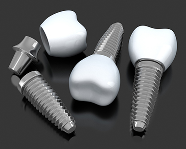 Three animated dental implant supported dental crowns