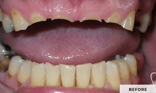 smiling patient