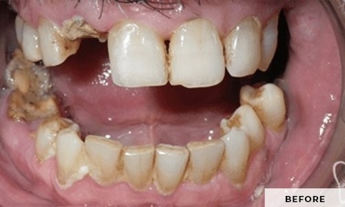 smiling patient