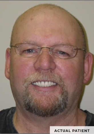smiling patient