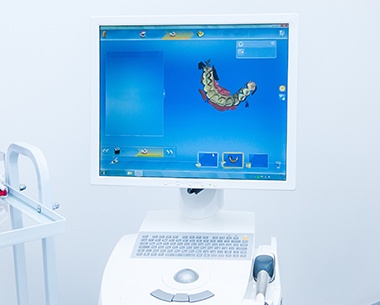 CEREC digital dental impression system
