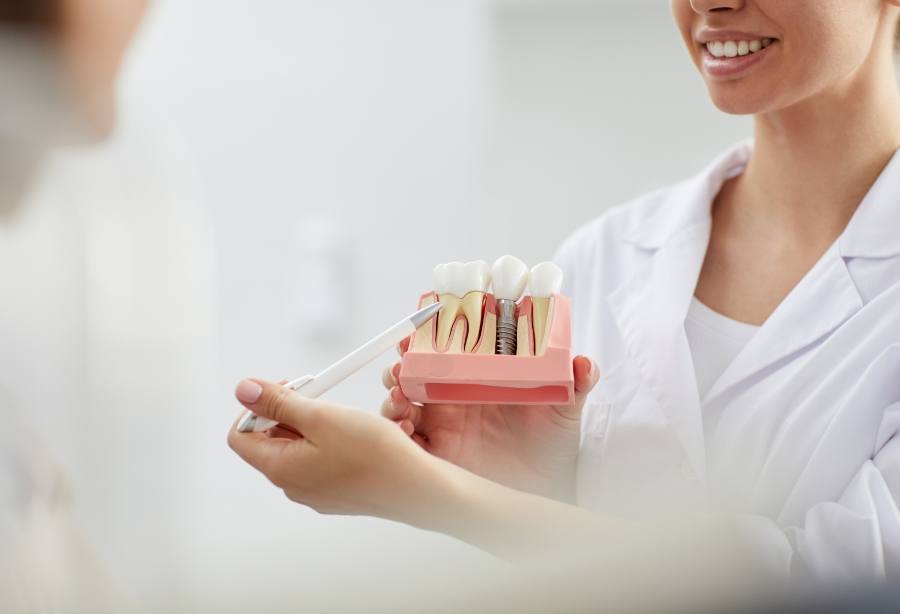 Dentist showing natural tooth and dental implant comparison model