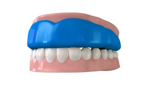 athletic mouthguard