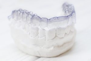 Invisalign on dental mold