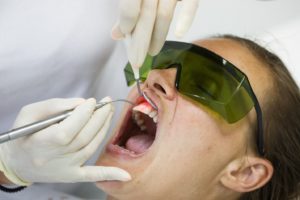 Dentist using soft tissue laser.
