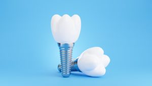 Two dental implants and crowns arranged against blue background