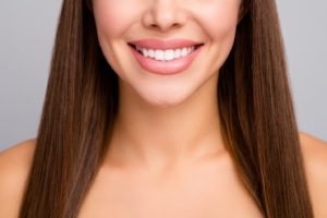 Woman’s beautiful smile after receiving veneers or Lumineers