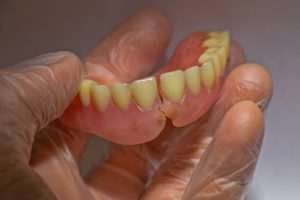  Close-up of gloved hand holding broken denture against neutral background