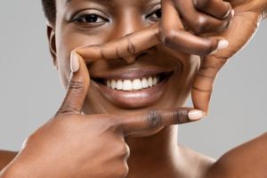 Woman framing teeth with fingers, showing her veneers