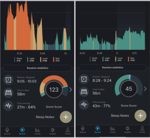 Patient’s Snore Score before and after NightLase (snoring reduction) treatment